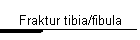 Fraktur tibia/fibula