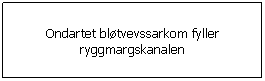 Tekstboks: Ondartet bltvevssarkom fyller ryggmargskanalen
